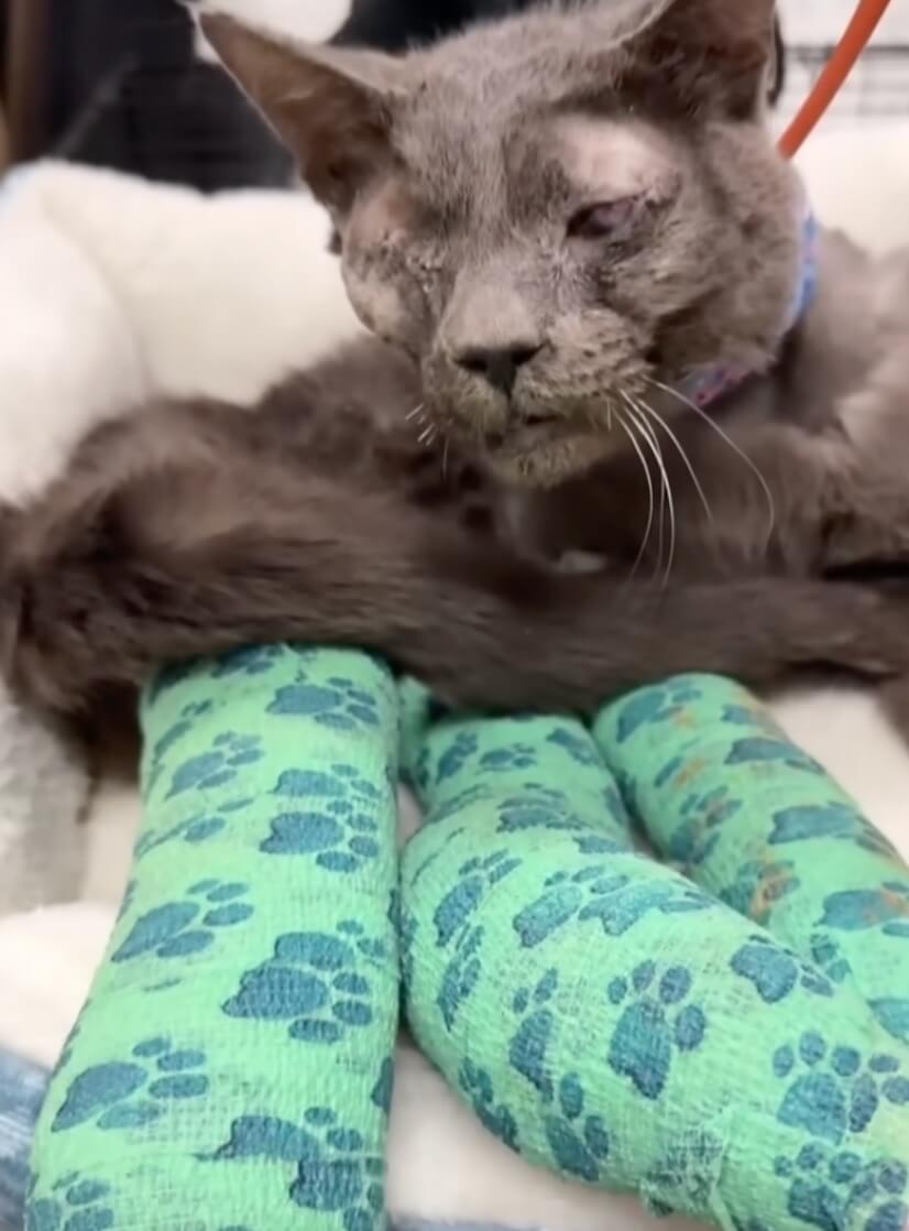 Bianca after her multiple surgeries