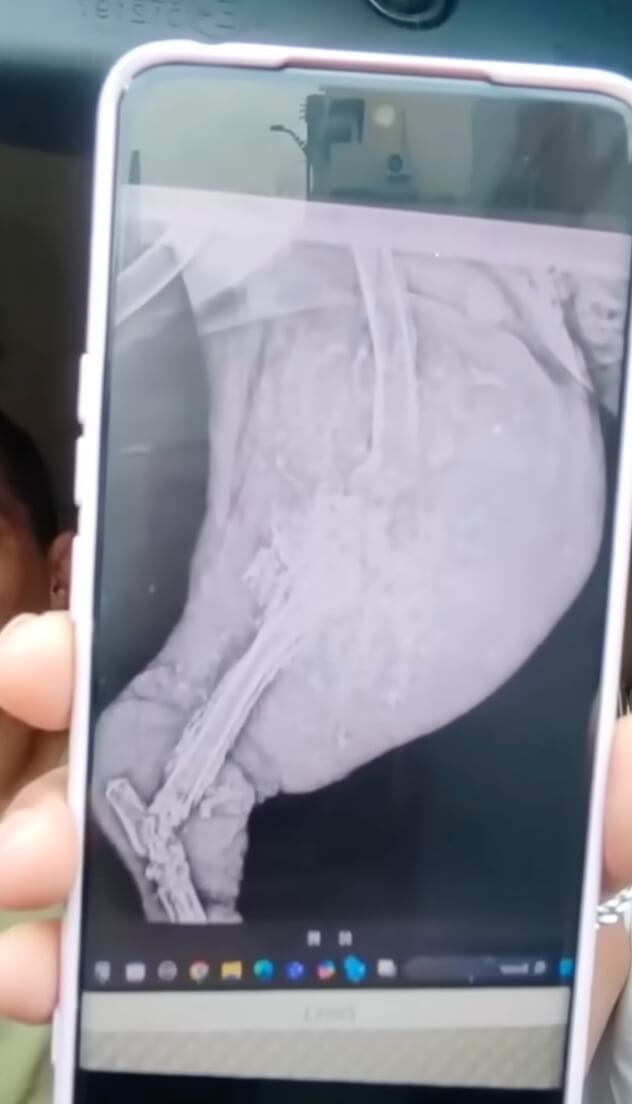 Duke's condition initially