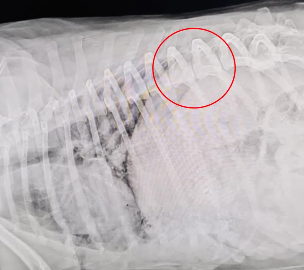 Risas's x-ray report